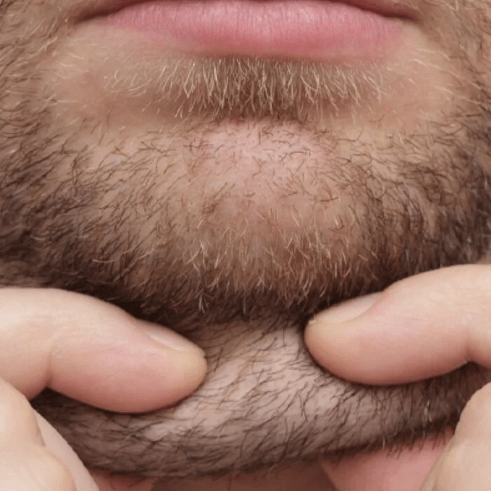 Cómo eliminar la papada o doble barbilla en menos de 24 horas